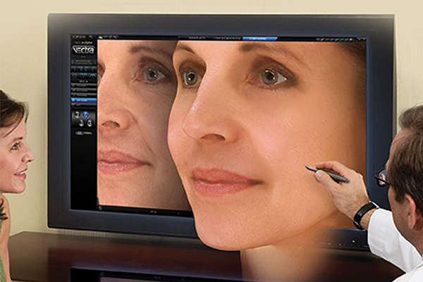 VECTRA 3D IMAGING FOR HEAD & NECK