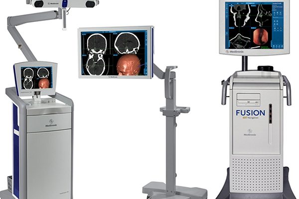 THE FUSION™ ENT NAVIGATION SYSTEM